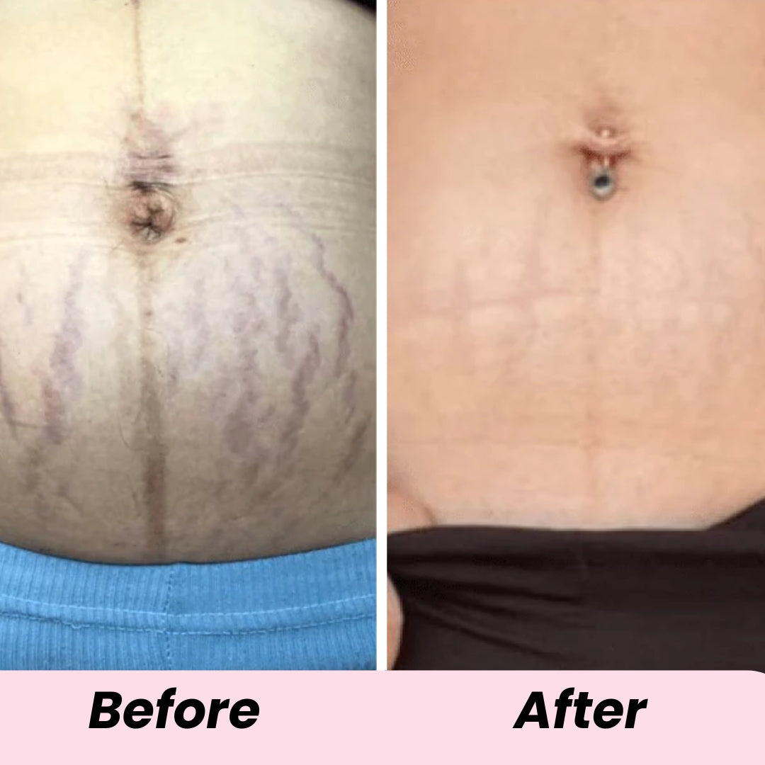 luvevly® Overnight Toning Whip
