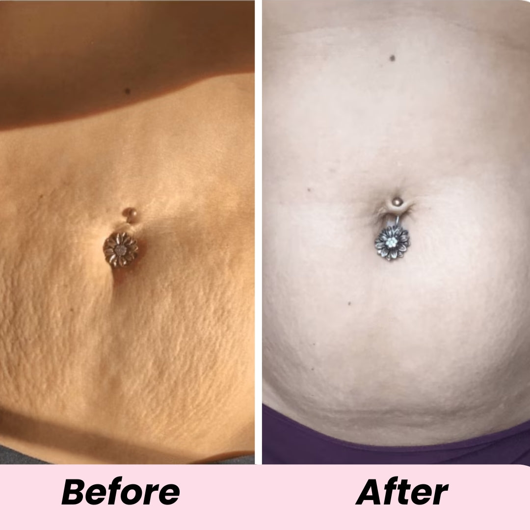 luvevly® Overnight Toning Whip