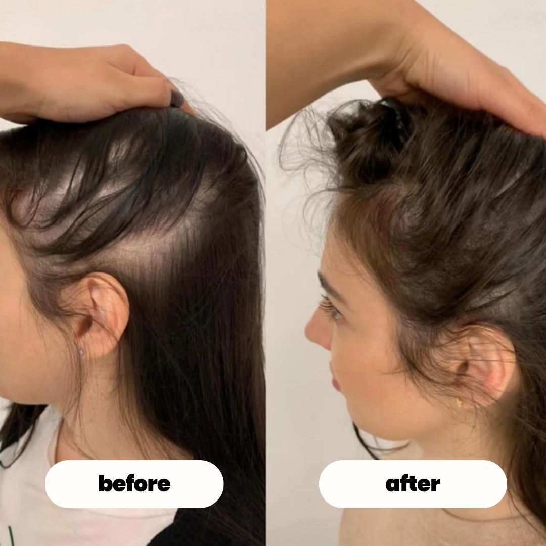 luvevly® Hair Growth Serum