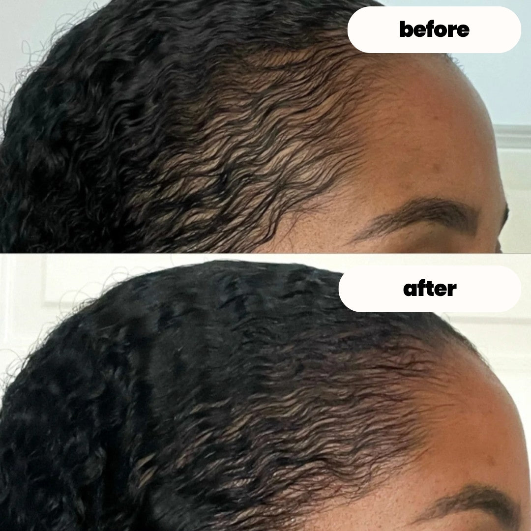 luvevly® Hair Growth Serum