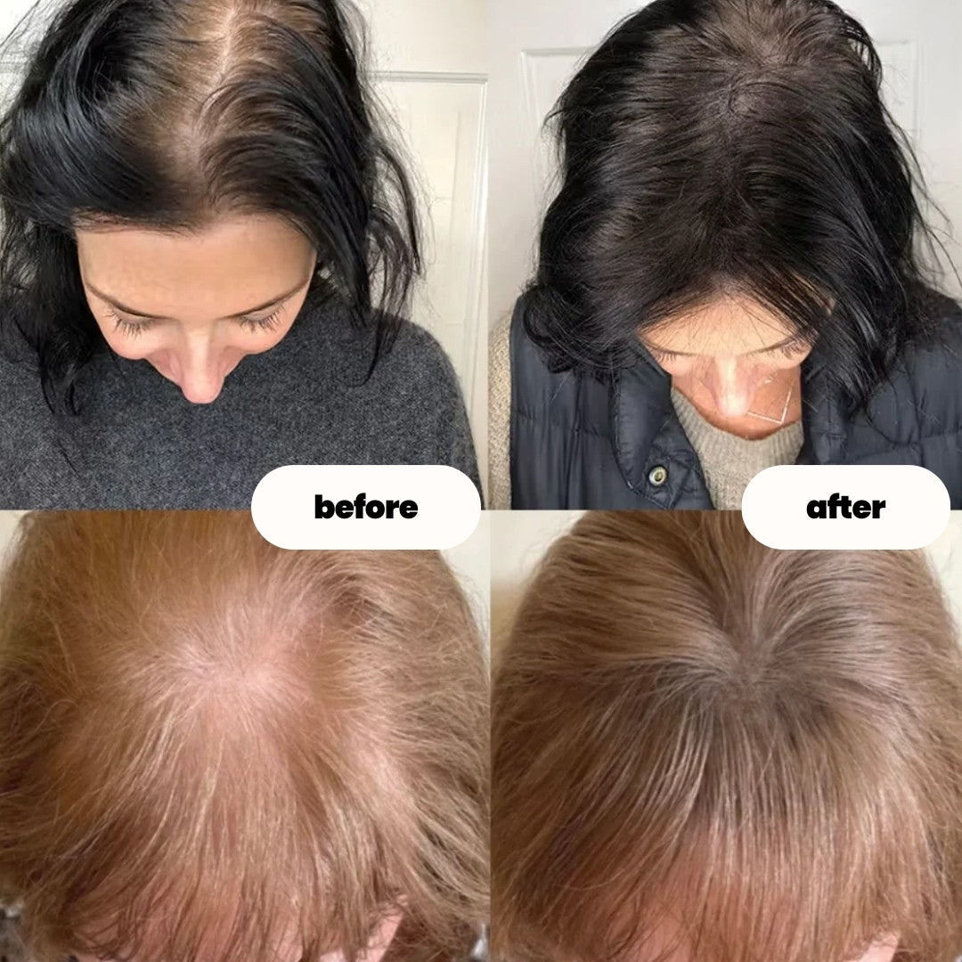 luvevly® Hair Growth Serum