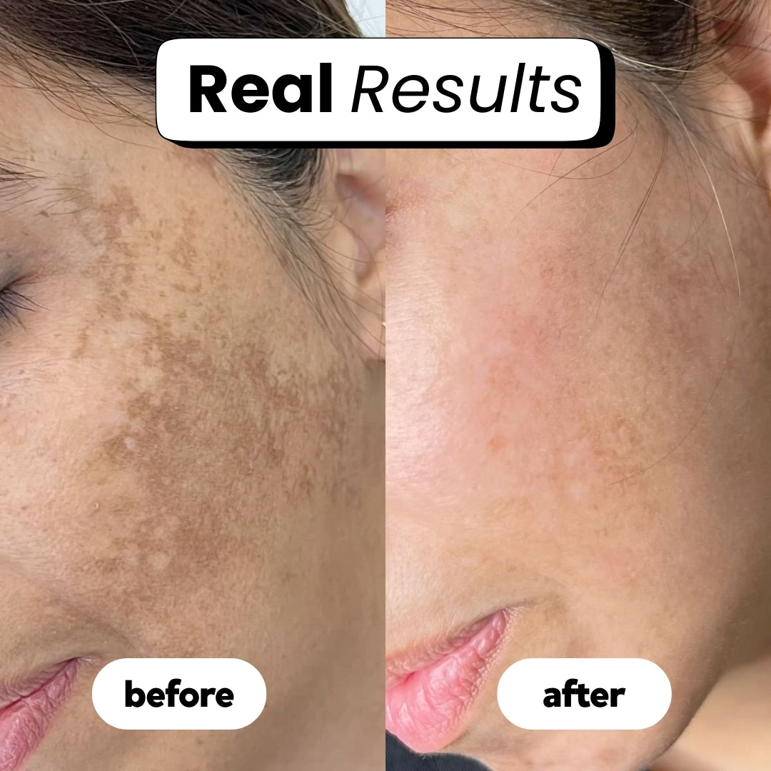 luvevly® 345 Relief Cream