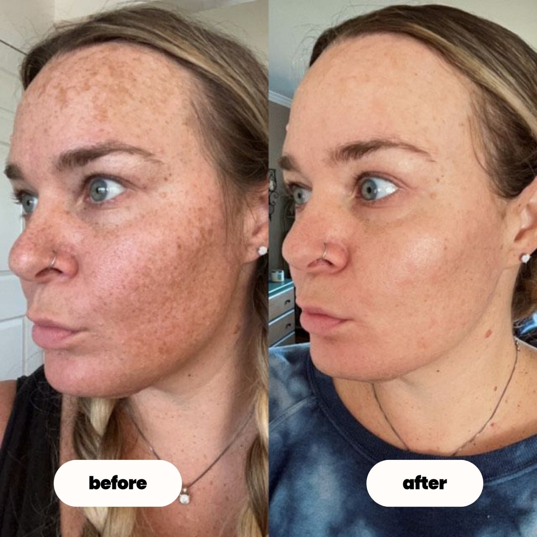 luvevly® 345 Relief Cream