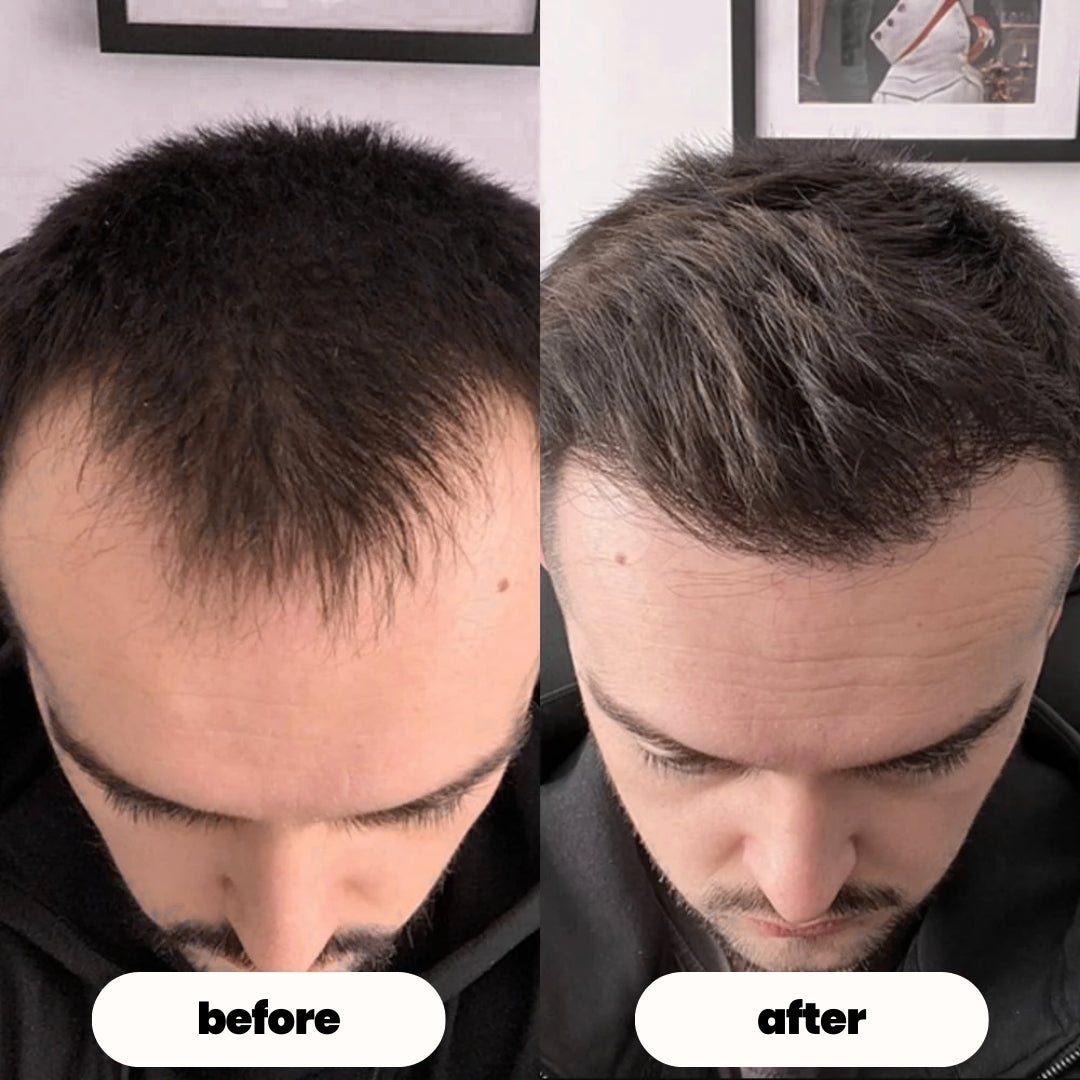 luvevly® Hair Growth Serum