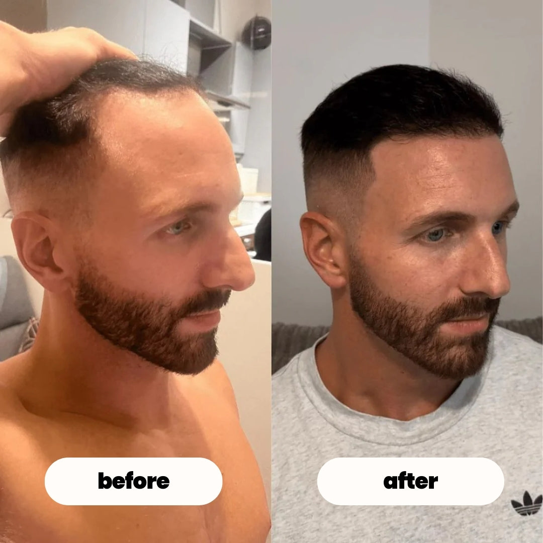 luvevly® Hair Growth Serum