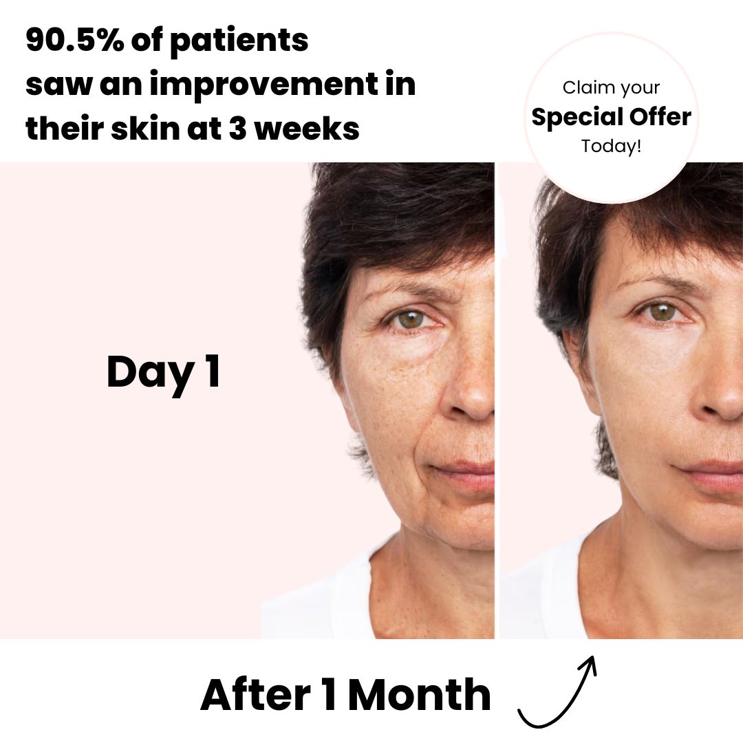 luvevly® Night Collagen Wrap KIT