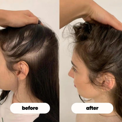 luvevly® Hair Growth Serum