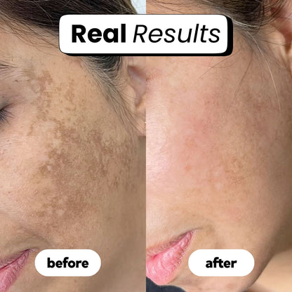 luvevly® 345 Relief Cream