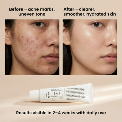 luvevly® 345 Relief Cream